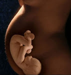 ESPINACA: Muy adecuada en la etapa de embarazo.