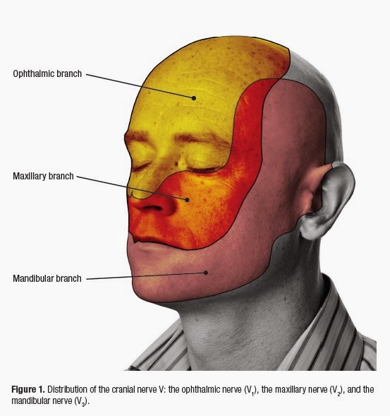 Trigeminal Neuralgia WHY has this happened and WHY does it hurt?