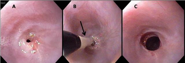 Distal Small Intestinal Disease Dogs Distal Small Intestinal Disease Dogs