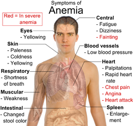 NCP for Anemia