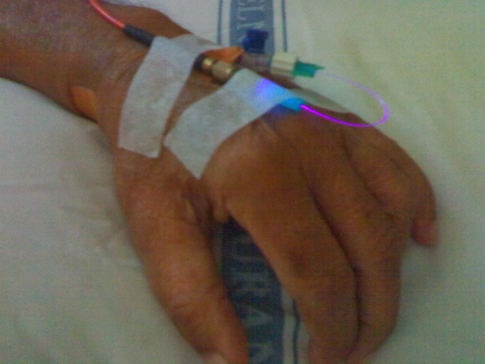 Thesis on hand therapy