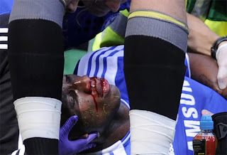 Didier Drogba sufre aparatosa lesión