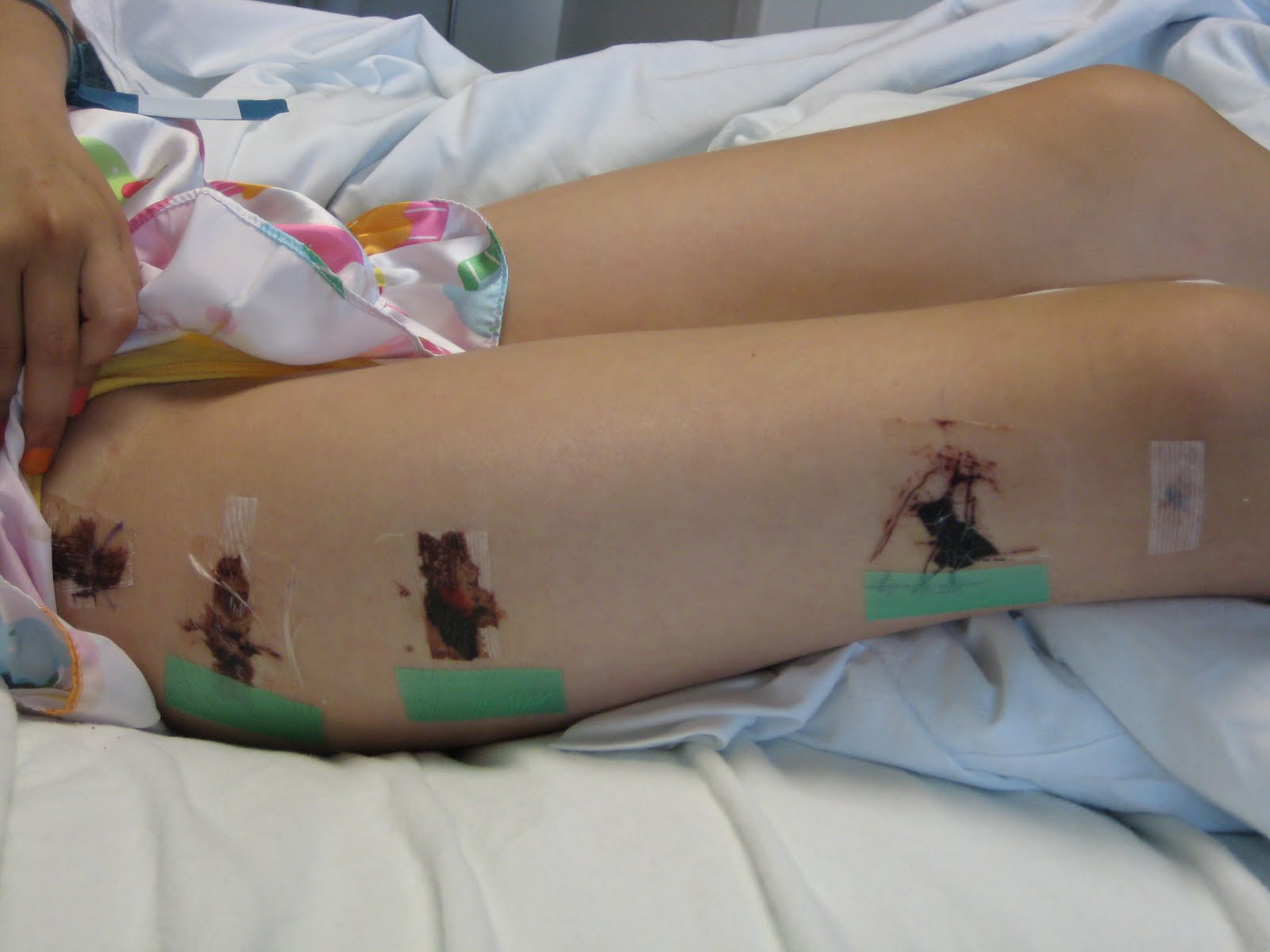 Dear Blog: The hip bone is connected to the thigh bone, the thigh bone.