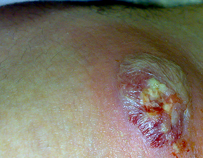 Eso es asi: LA PELIGROSA ARAÑA DE RINCÓN UN PELIGRO EN CADA RINCON