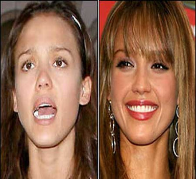 http://2.bp.blogspot.com/-32d5Oj1VG04/Tq6abanOfuI/AAAAAAAAApg/OwaqXMtP_Jw/s400/jessica-alba-nomakeup.jpg
