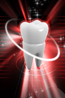 All on Four Dental Implants All on Four Dental Implants