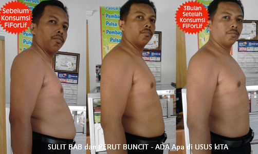 BAHAYA PERUT BUNCIT