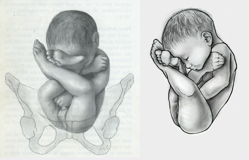 andreea margineanu biomedical illustration and animation Fetal