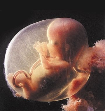 fetus.jpg