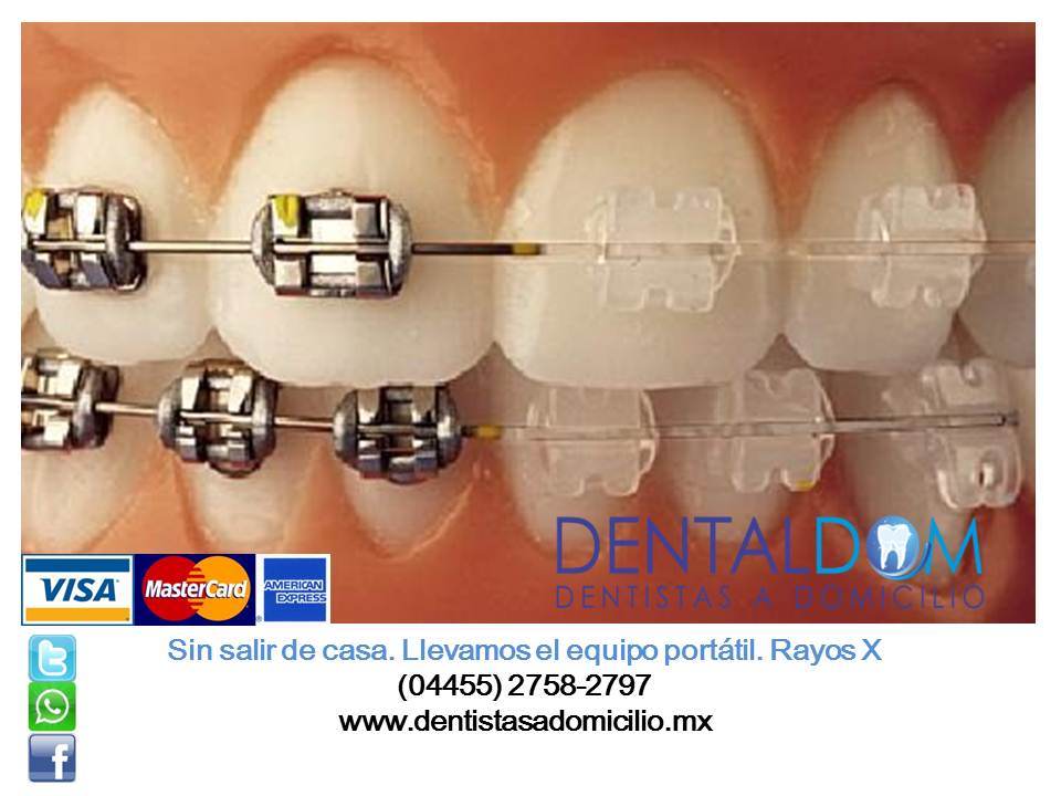 DENTISTAS A DOMICILIO DENTALDOM