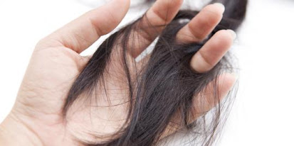 Tips dan Cara Mencegah Rambut Rontok Dengan Cara Alami Mencegah kerontokan rambut