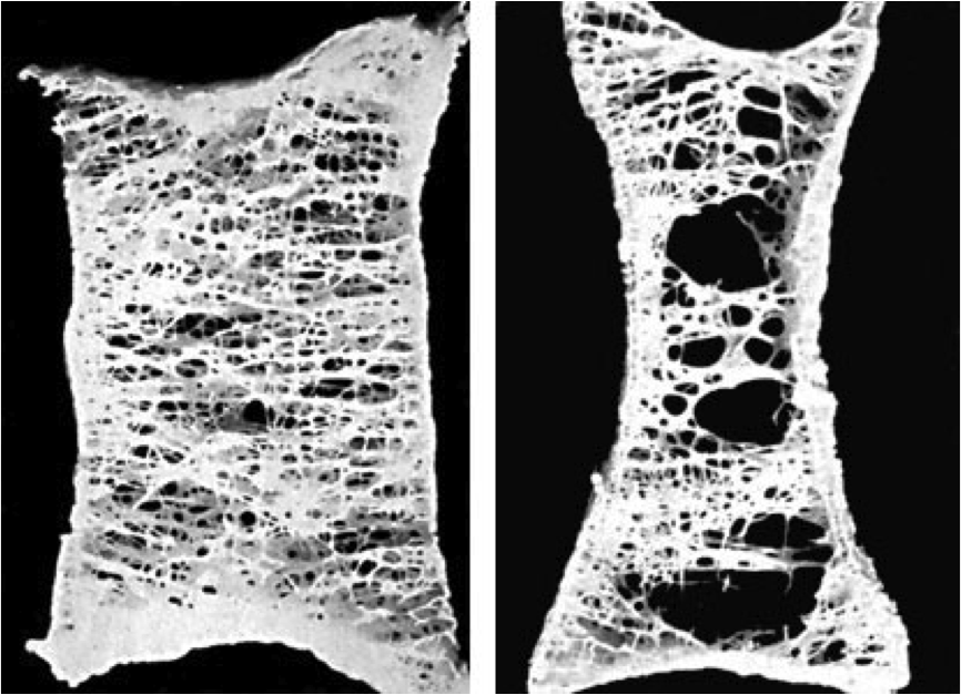Escaping Anergy: The Immunology Research Blog: Silencing "The Silent
