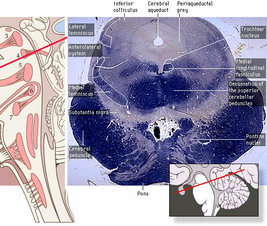 Notez On Nursing....: Cranial Nerve IV - Trochlear Nerve Review.....