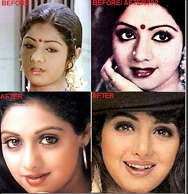Bollywood Actress Before and After Plastic Surgery | Crazy Pictures of