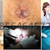 Waspadai..!! Mengejan BAB Terlalu Kuat Jadi Ambeien thumbnail