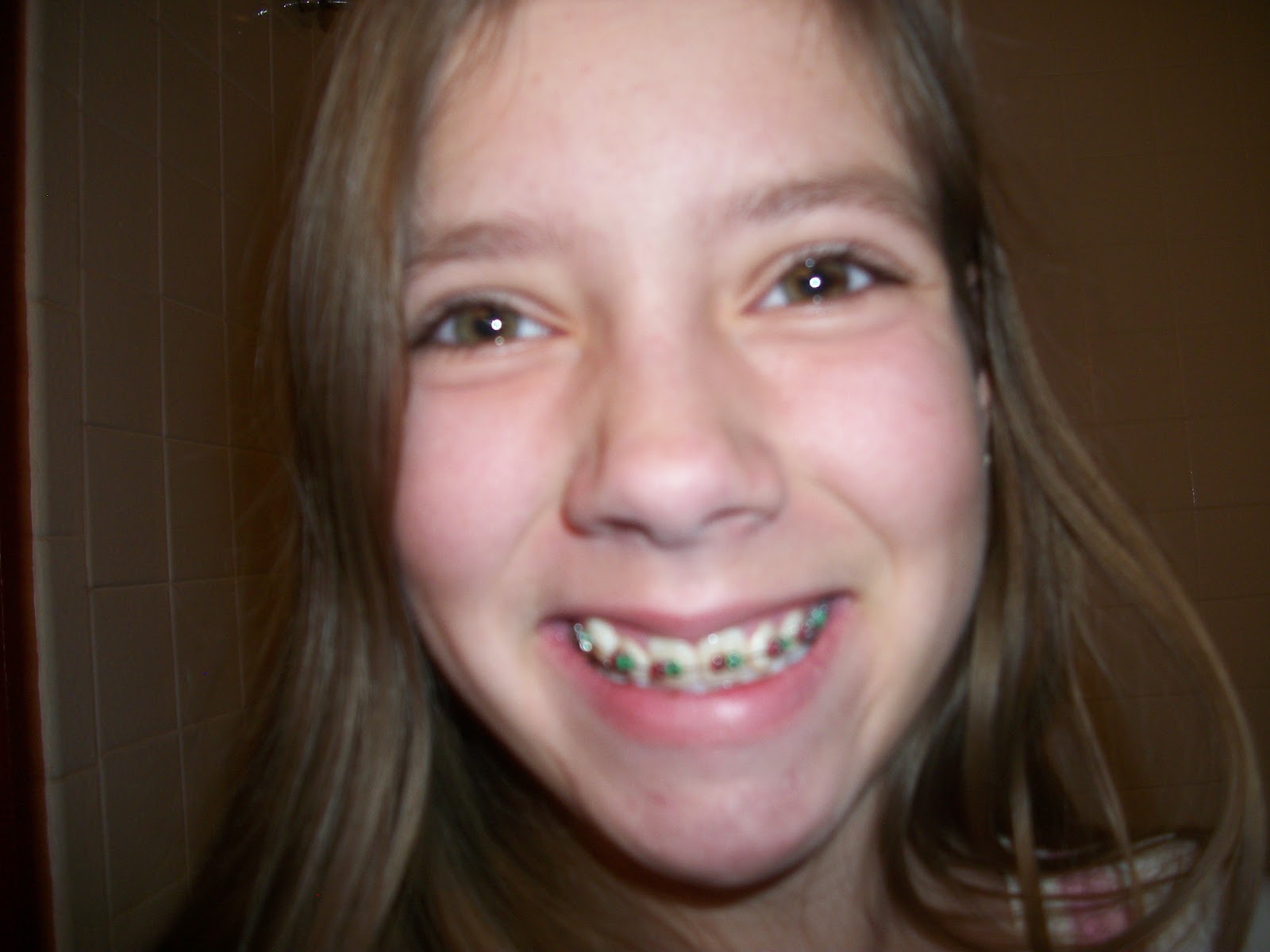 Life Through Ellie's Eyes Braces