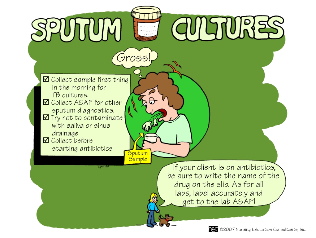 sputum culture