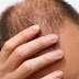 Queda de cabelo está entre principais queixas em consulta, afirma dermatologista