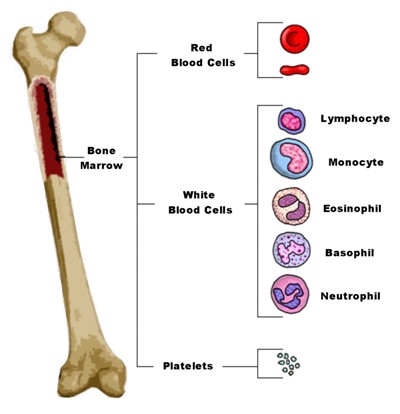 leukemia marrow blood bone cells treatments medical