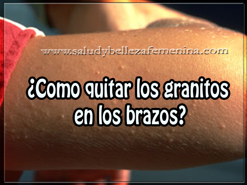Como quitar los granitos en los brazos Cuidados de la piel , belleza , como quitar los granitos en los brazos