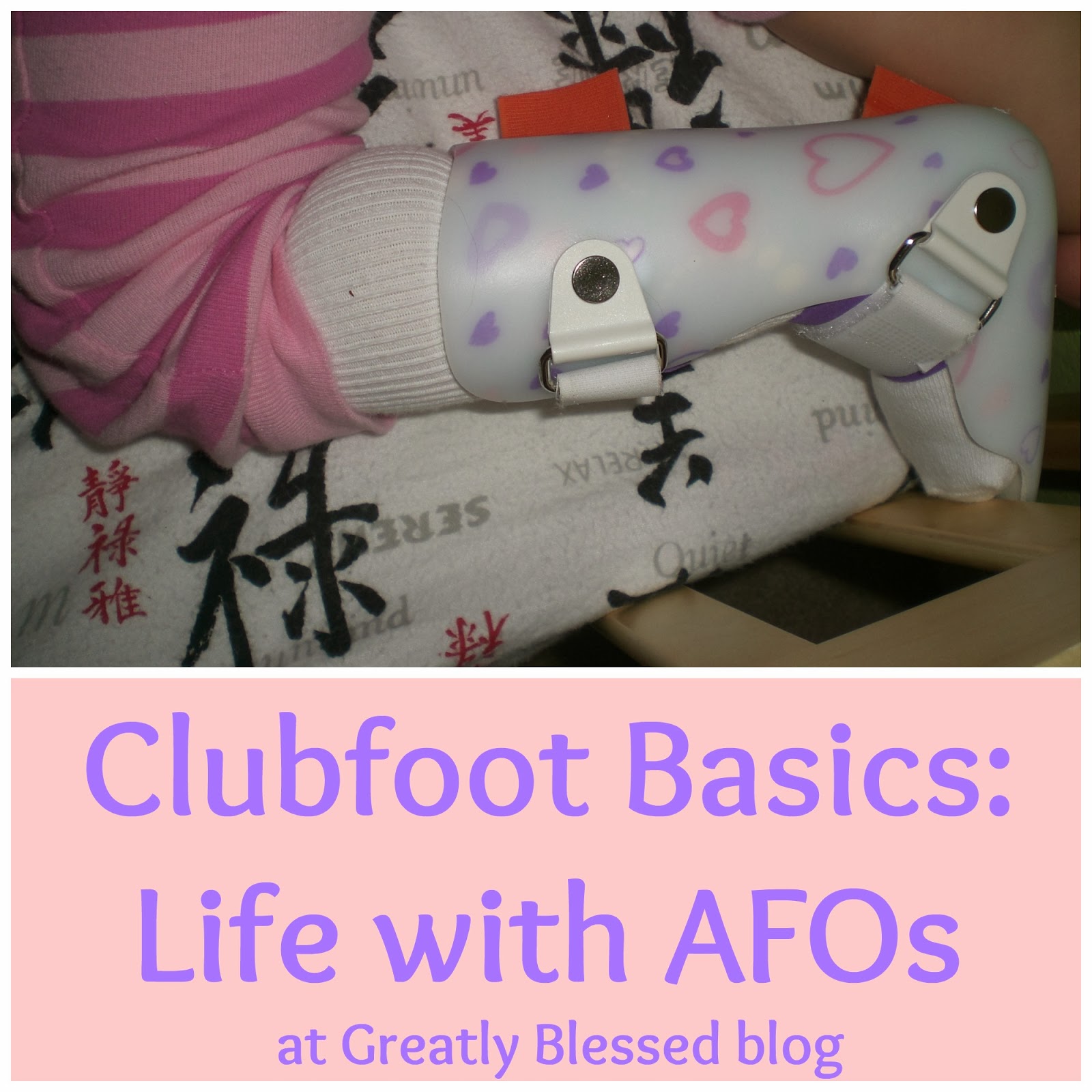 Greatly Blessed Clubfoot Basics Life with an AFO