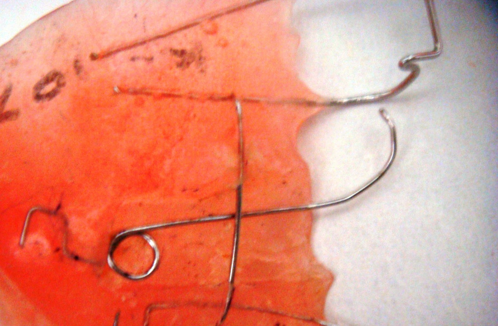 Dentistry lectures for MFDS/MJDF/NBDE/ORE A Note on Active Components