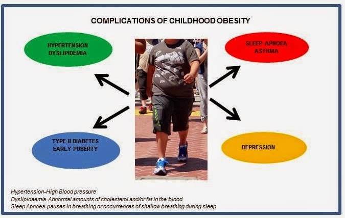 Children Obesity Essay