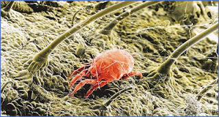 dust-mite-body-hair.