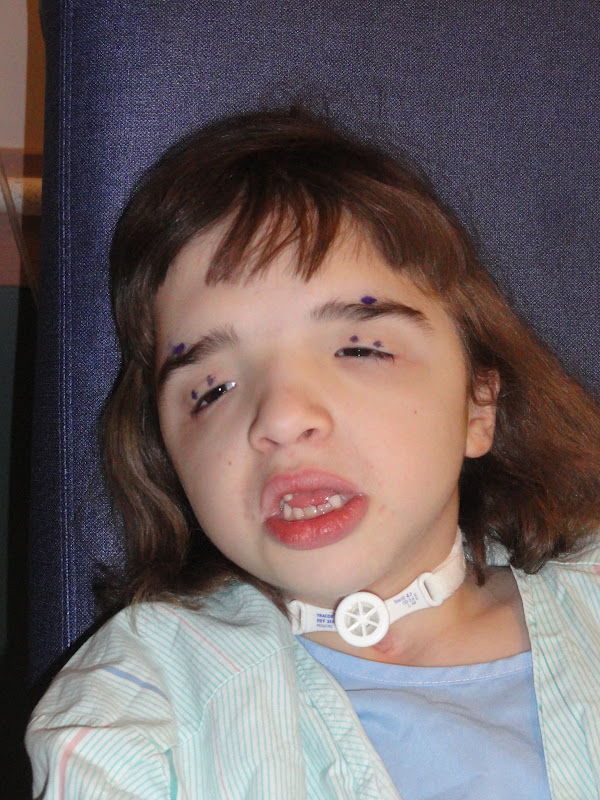 Ainsley Rae Happy To Be Me Frontalis Sling Surgery Started