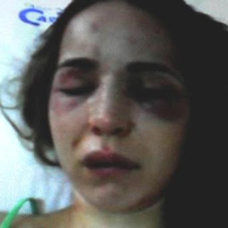 FOTOS DE MUJERES GOLPEADAS fotos de mujeres golpeadas: