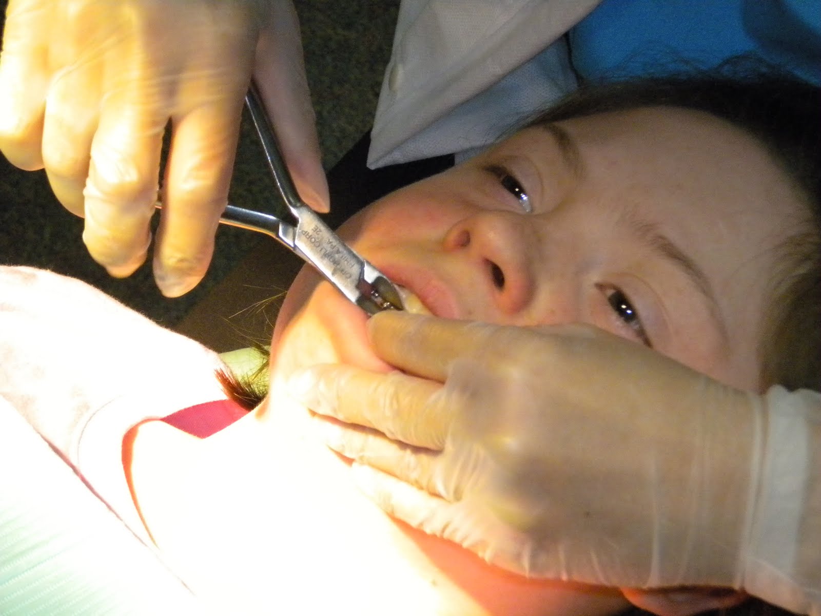 Care Bear Design The braces come off!