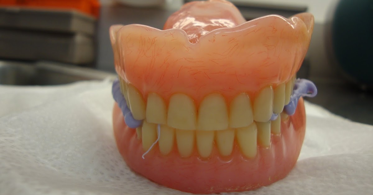 2011 Summer Rotation 1 Asheville, NC Day 5 Tori Removal