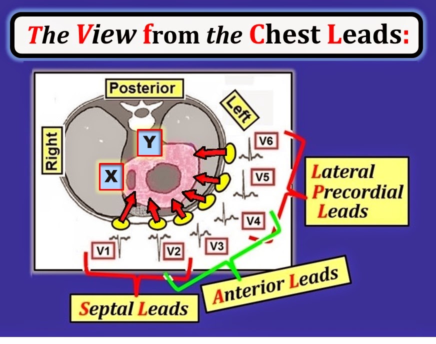 ECG Interpretation ECG Blog 91 (Basic Concepts4) Lead Groupings