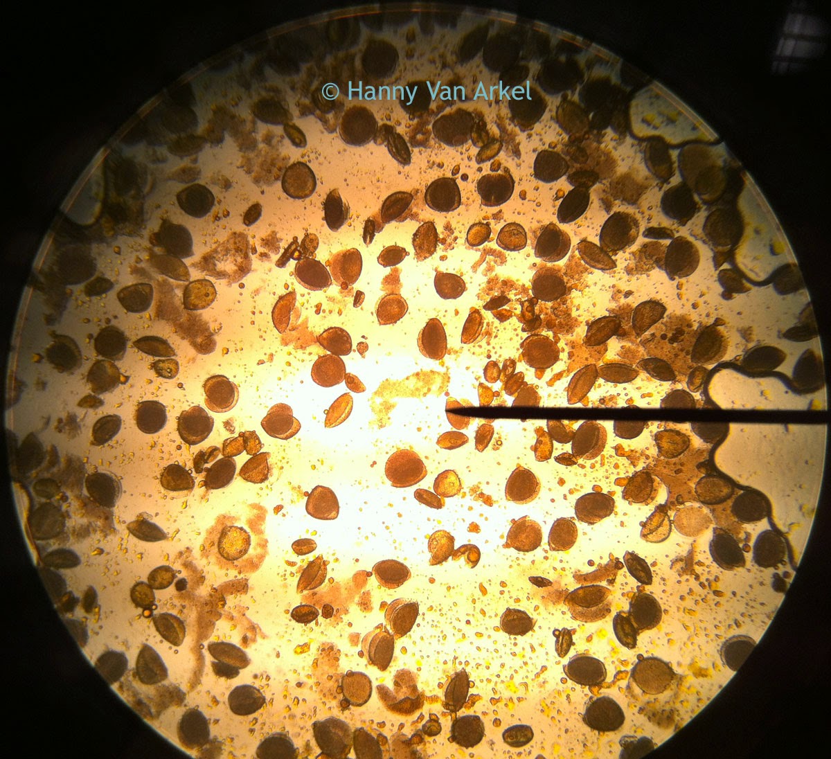 Pollen captured under microscope at 100x