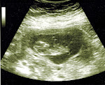 Peanut # 6, Due September 5th, 2013