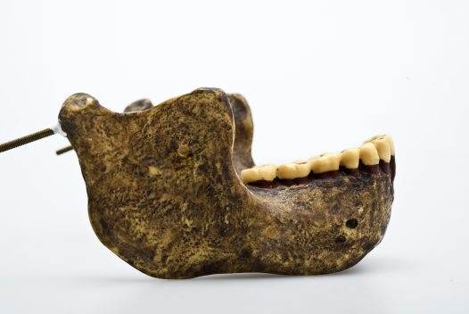 Dirk Drubbel 1 3 13 1 4 13