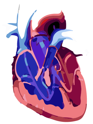 Tetralogy of Fallot 