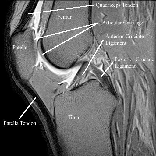 mri anatomy of knee joint radiology