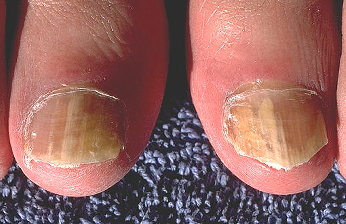 On average, they grow to be about 0.05 to 1.2 mm per week. Healthy nails
