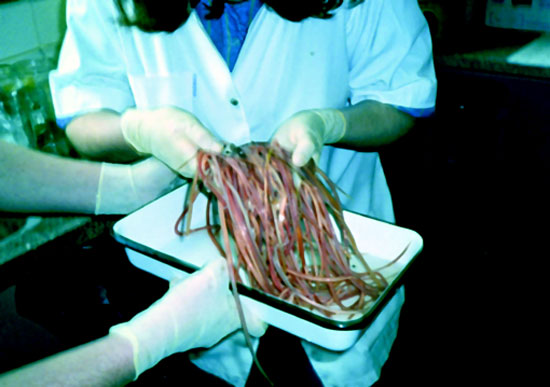 Onde é possível tomar um teste de sangue em helminths