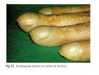 Acropaquia Acropaquia