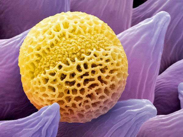 Gerrys Blog Die Welt Unter Dem Mikroskop