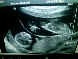 Ultrasound, 15 weeks