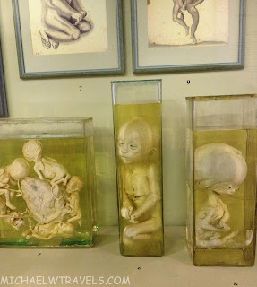 a group of fetus in glass containers