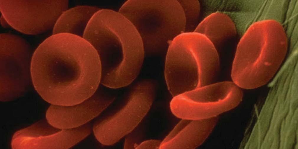 Thalassemia Association Malaysia