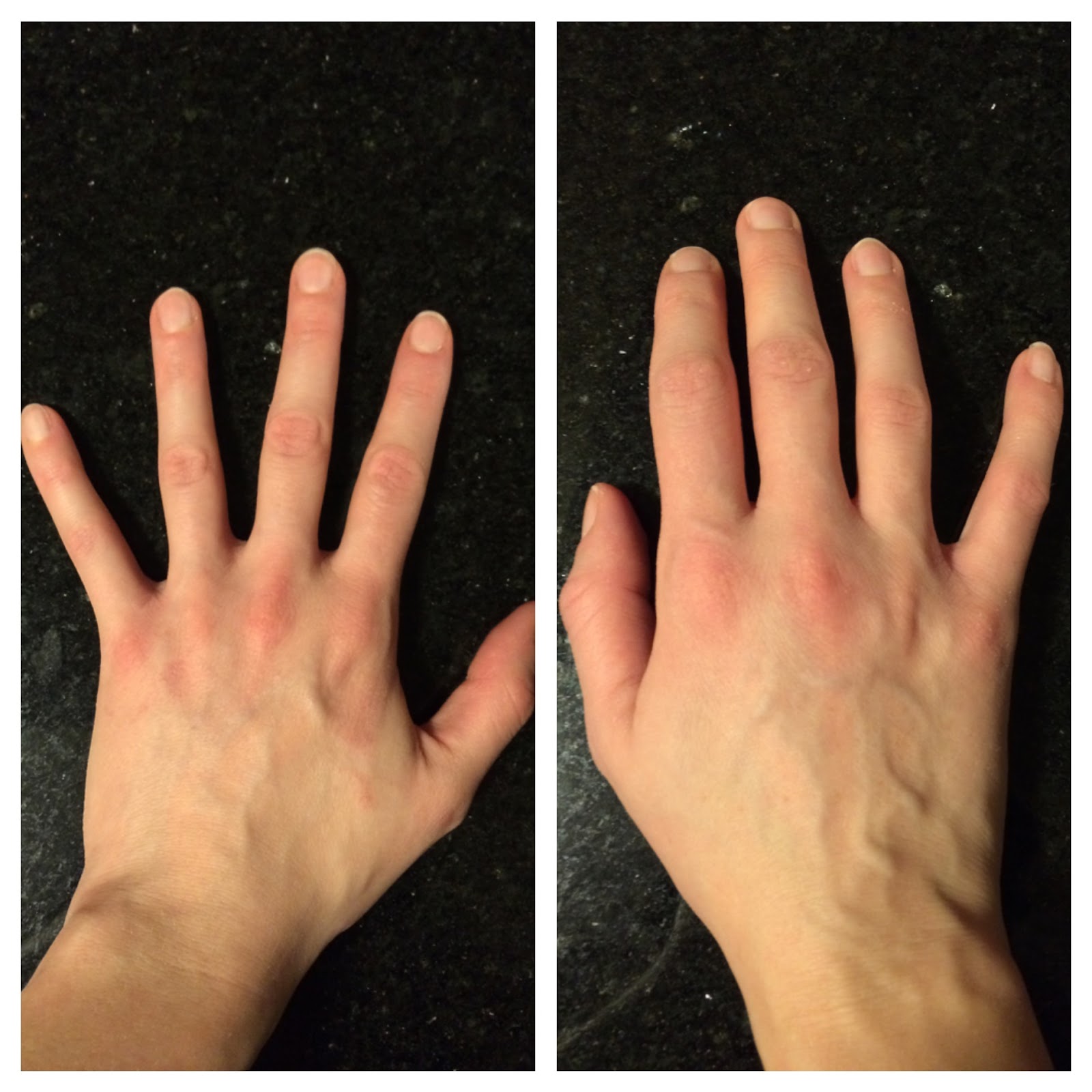 Lisa's Yarns Living with RA My First Flare