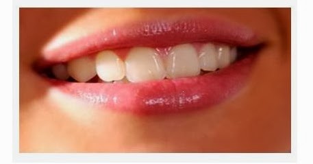 Cara Memerahkan Bibir Secara Alami dan Permanen - METROPOLIS STYLE