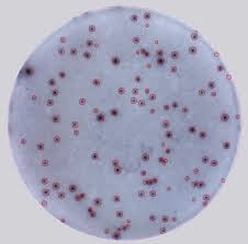 elisa spot assay protocol elisa spot assay protocol