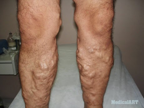 saglikli yasam saglik onerileri blogger