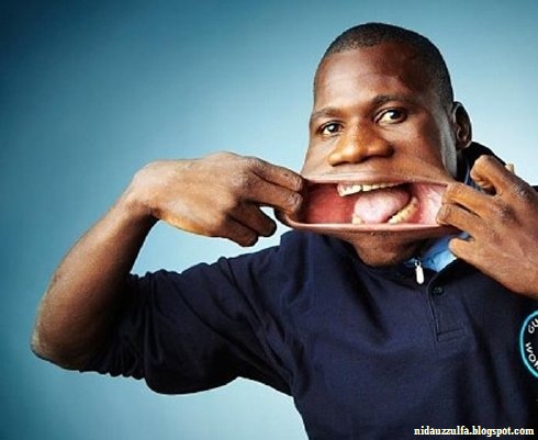 Manusia Dengan Mulut Kudanil Seperti Manusia Mulut Karet